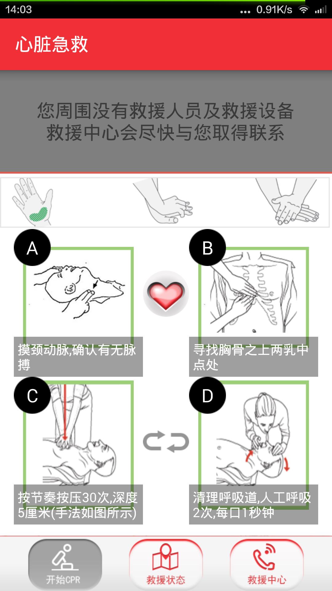 心脏急救
